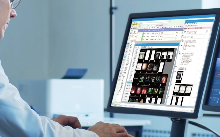 電子カルテ